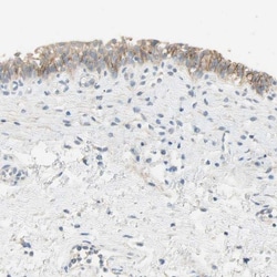 Nectin-4/PVRL4 Antibody, Novus Biologicals 25 &mu;L; Unlabeled:Antibodies,